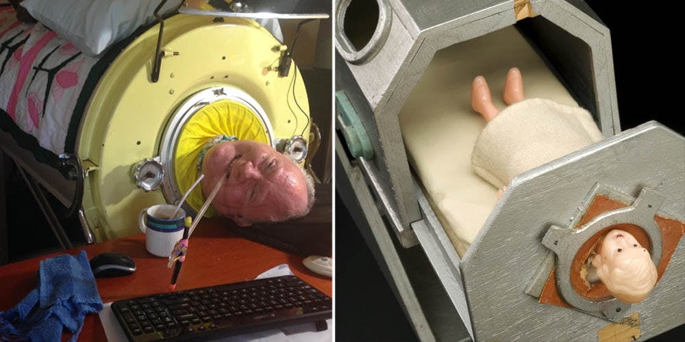 This Man Has Been Using An Iron Lung Since 1952 The Iron Lung Memes