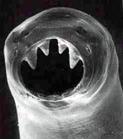 Can Parasites Travel Up Pee Can Parasites Travel Up Pee