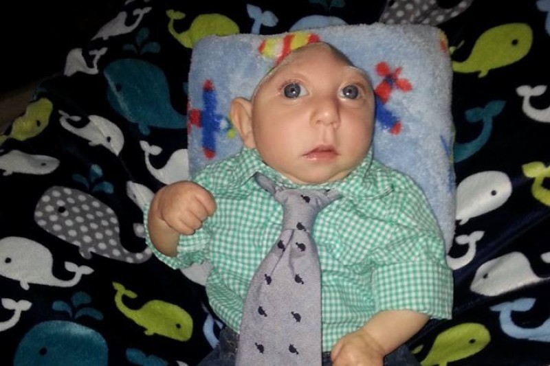 This Baby With a Brain Malformation Just Celebrated His First Birthday